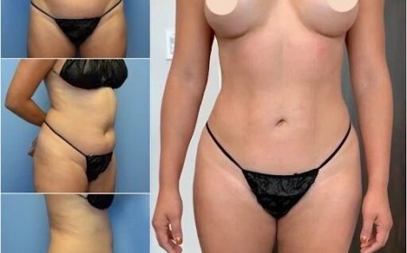 Body Contouring in Dubai: Safe and Effective Ways to Sculpt Your Body