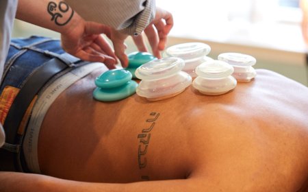 Cupping Therapy in Philadelphia: Traditional Healing, Modern Revival